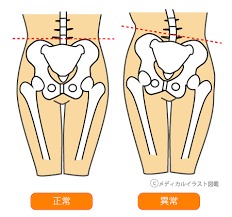 02：骨盤と背骨を整えるスペシャリストです。