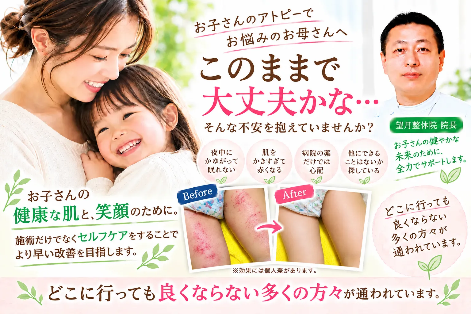 赤ちゃん・子供のアトピー | 望月整体院 | 大阪市生野区鶴橋であなたのお悩みを早期改善！